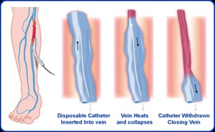 BestVeinDoctorNYC1