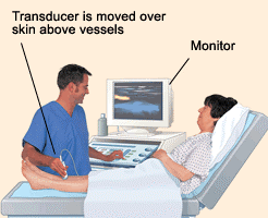 Venous-Ultrasound-nyc