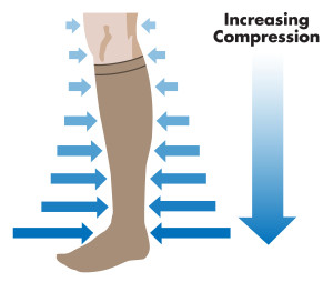 Compression Stocking