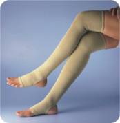 varicose vein treatment legs