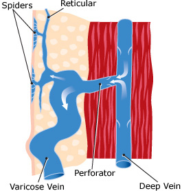 reticular veins