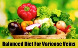 What to Eat for Reducing Varicose Veins Symptoms