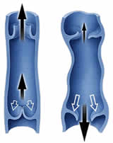 venous-insufficiency